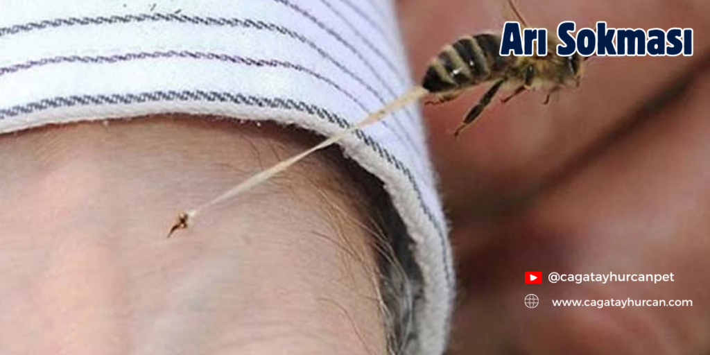 Arı sokması